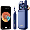 Прибор для удаления ушной серы (отоскоп) Xiaomi Bebird EarSight Plus (D39R) Blue цена