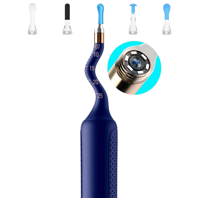 Прибор для удаления ушной серы (отоскоп) Xiaomi Bebird EarSight Plus (D39R) Blue  в Украине