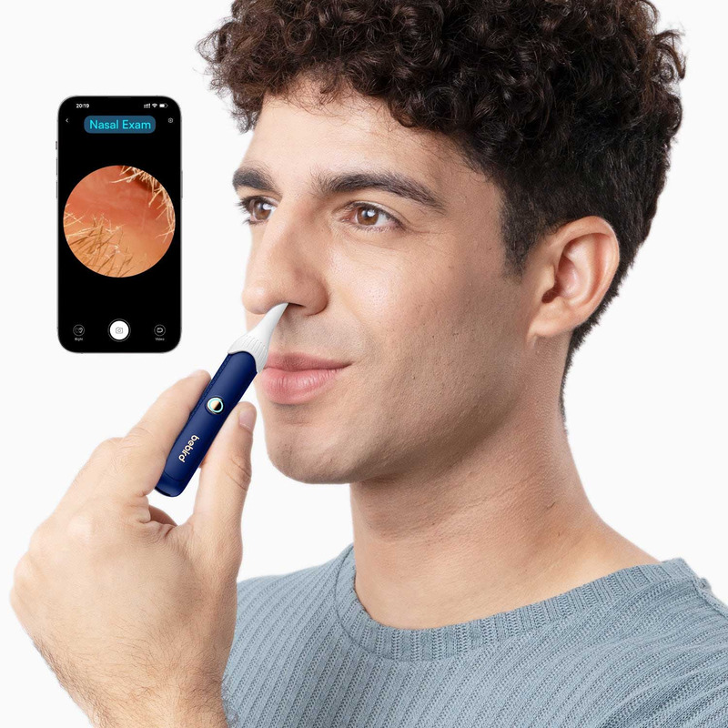Прибор для удаления ушной серы (отоскоп) Xiaomi Bebird EarSight Plus (D39R) Blue  фото товара