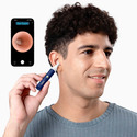 Прибор для удаления ушной серы (отоскоп) Xiaomi Bebird EarSight Plus (D39R) Blue  магазин