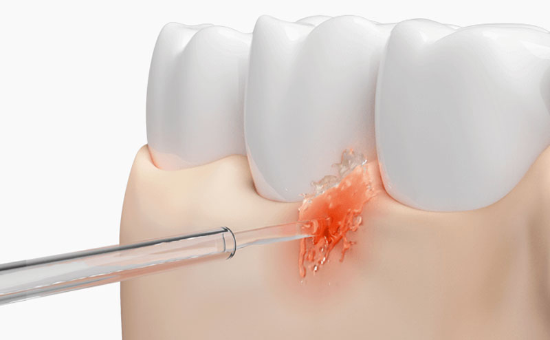 Іригатор Xiaomi MiJia Water Flosser 2 (MEO705)