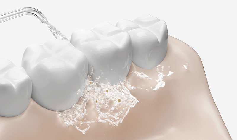 Іригатор Xiaomi MiJia Water Flosser 2 (MEO705)