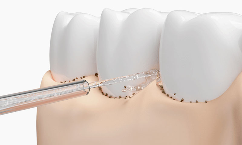 Іригатор Xiaomi MiJia Water Flosser 2 (MEO705)