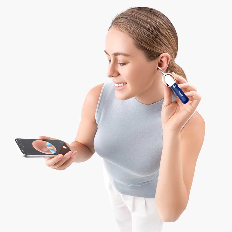 Підключення Xiaomi Bebird EarSight Plus D39R до смартфона