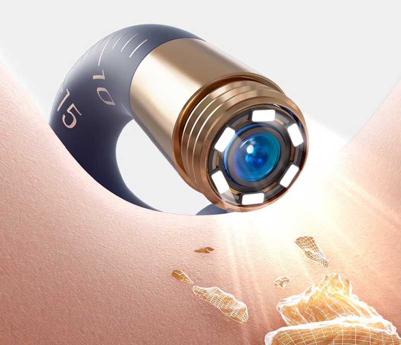 HD-камера отоскопа Xiaomi Bebird EarSight Plus D39R